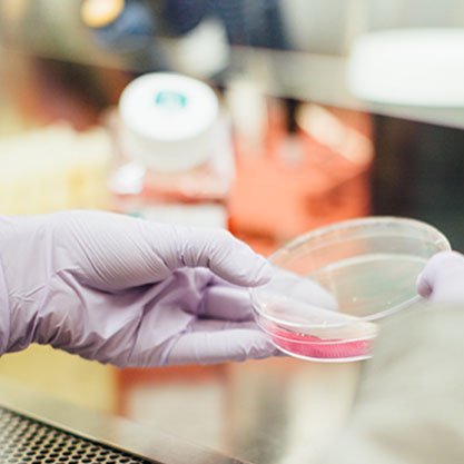 Nýtt fyrirkomulag skimana og gjald fyrir leghálsskimun lækkar